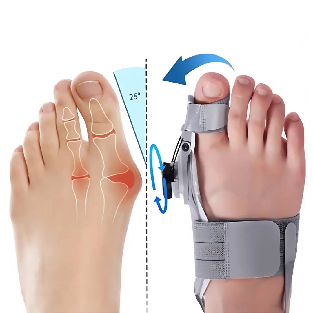 Bunion Relief Brace | Adjustable, Non-Woven Material & Rotatable Toe Separator for Hallux Valgus Pain Alleviation