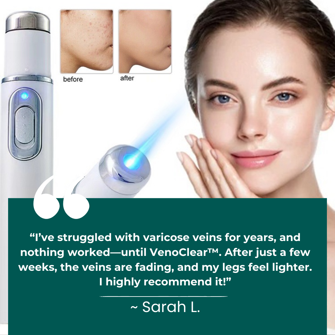 Non-Invasive Varicose Vein Treatment – VenoClear™ Laser Therapy Device