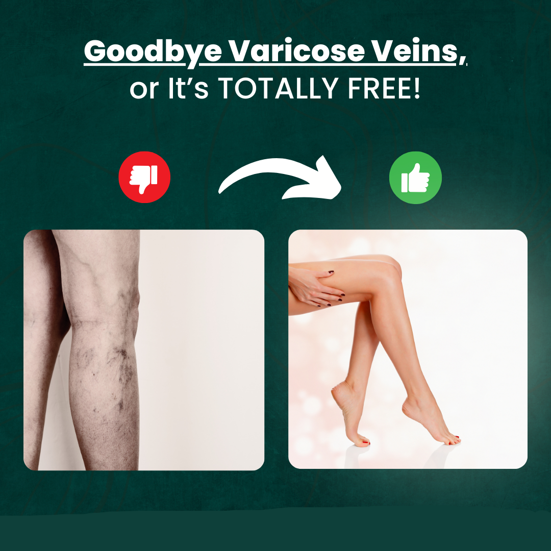 Non-Invasive Varicose Vein Treatment – VenoClear™ Laser Therapy Device