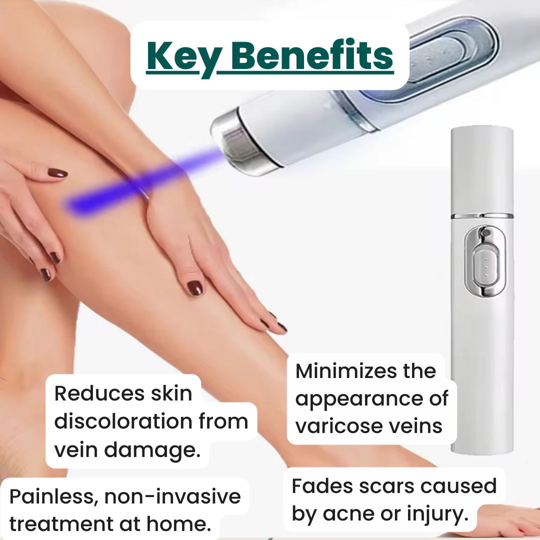 Non-Invasive Varicose Vein Treatment – VenoClear™ Laser Therapy Device