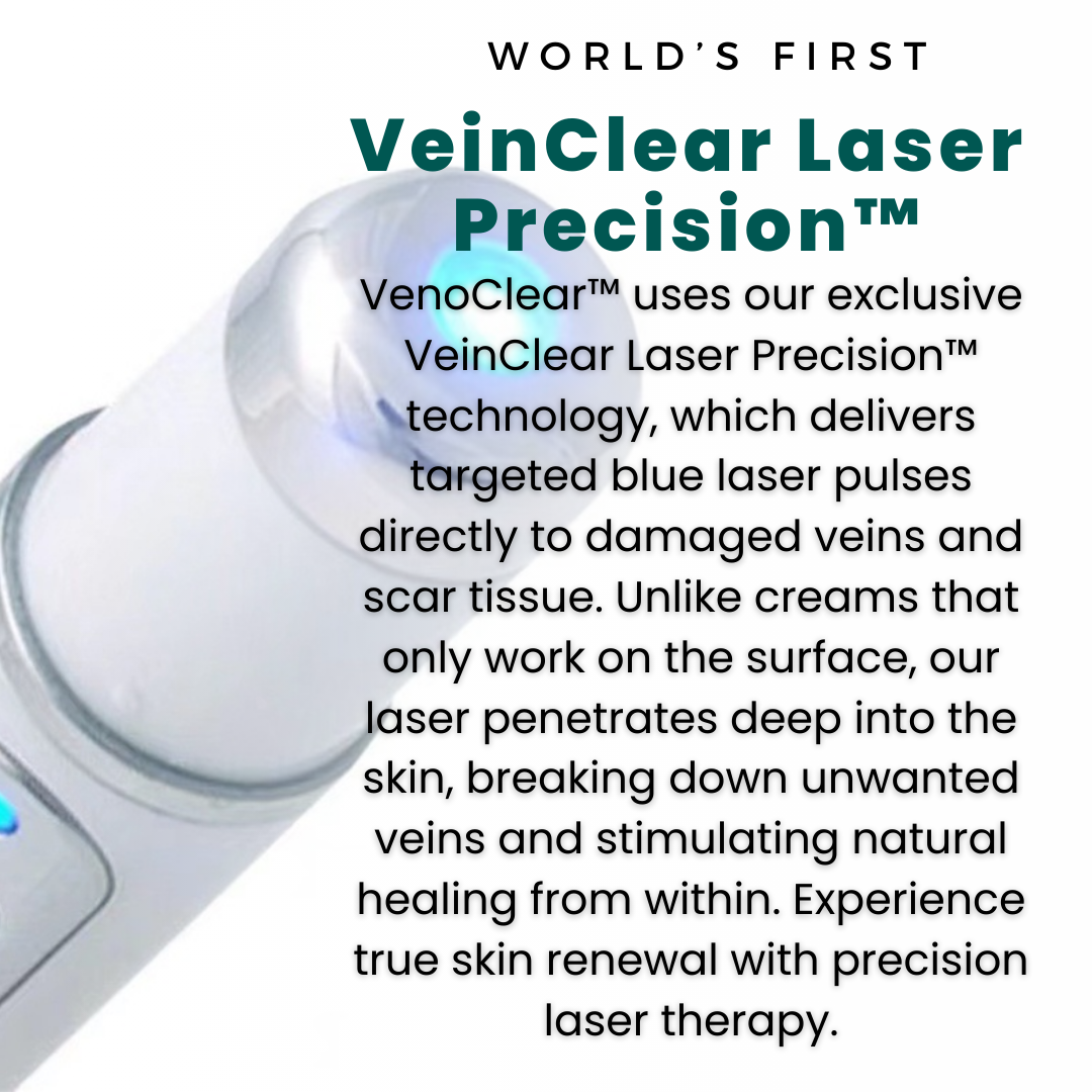 Non-Invasive Varicose Vein Treatment – VenoClear™ Laser Therapy Device