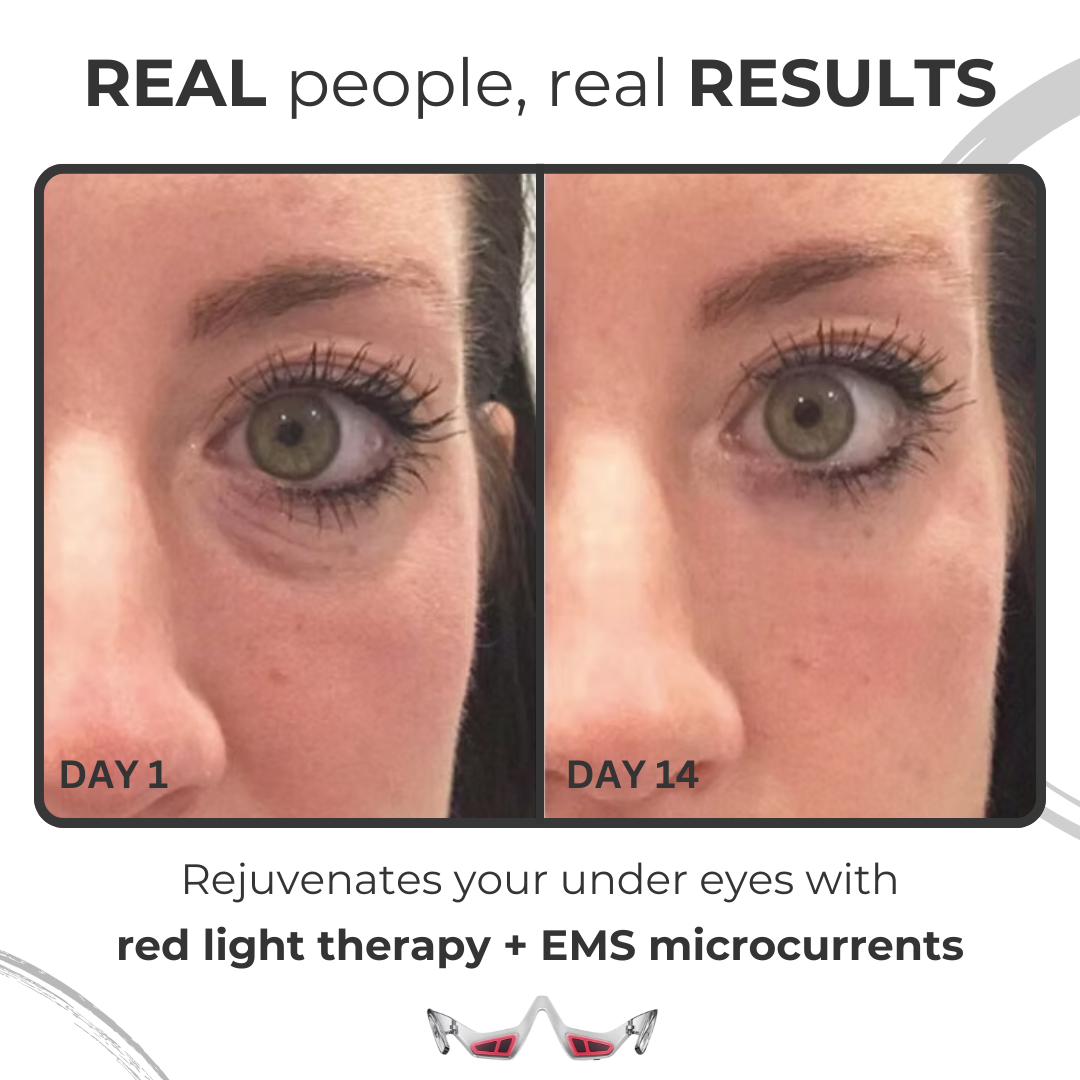 Under Eye Anti-Aging Glasses | Red Light Therapy & Microcurrents for Reducing Wrinkles, Dark Circles & Puffiness