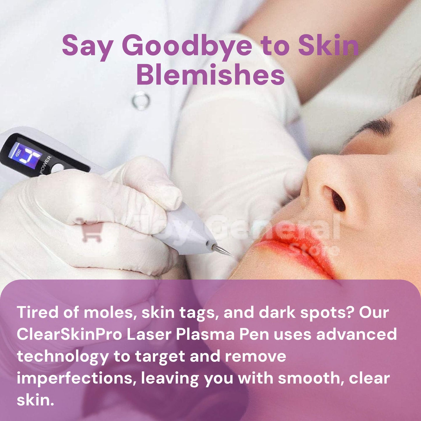 ClearSkinPro Laser Plasma Pen | Non-Invasive Freckle, Skin Tag, Spot, Mole & Tattoo Removal for At-Home Skin Care