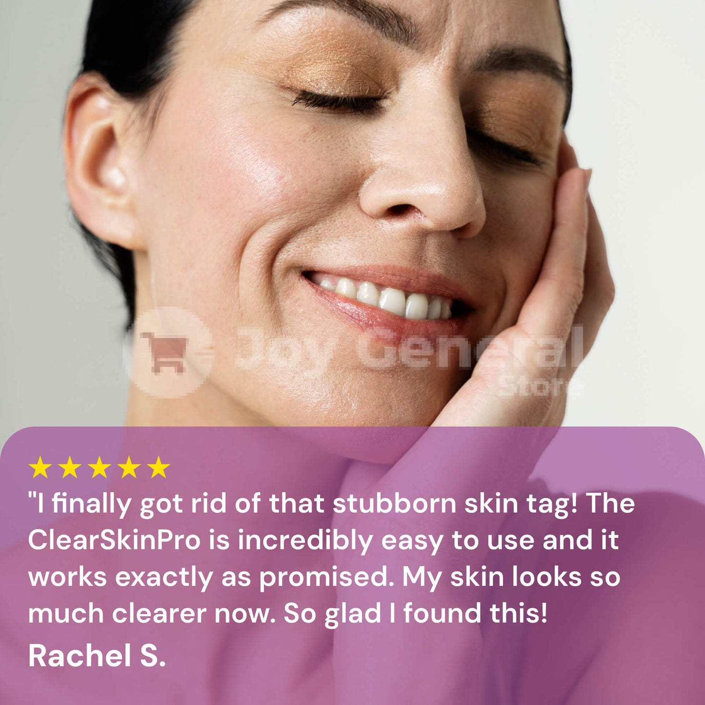 ClearSkinPro Laser Plasma Pen | Non-Invasive Freckle, Skin Tag, Spot, Mole & Tattoo Removal for At-Home Skin Care