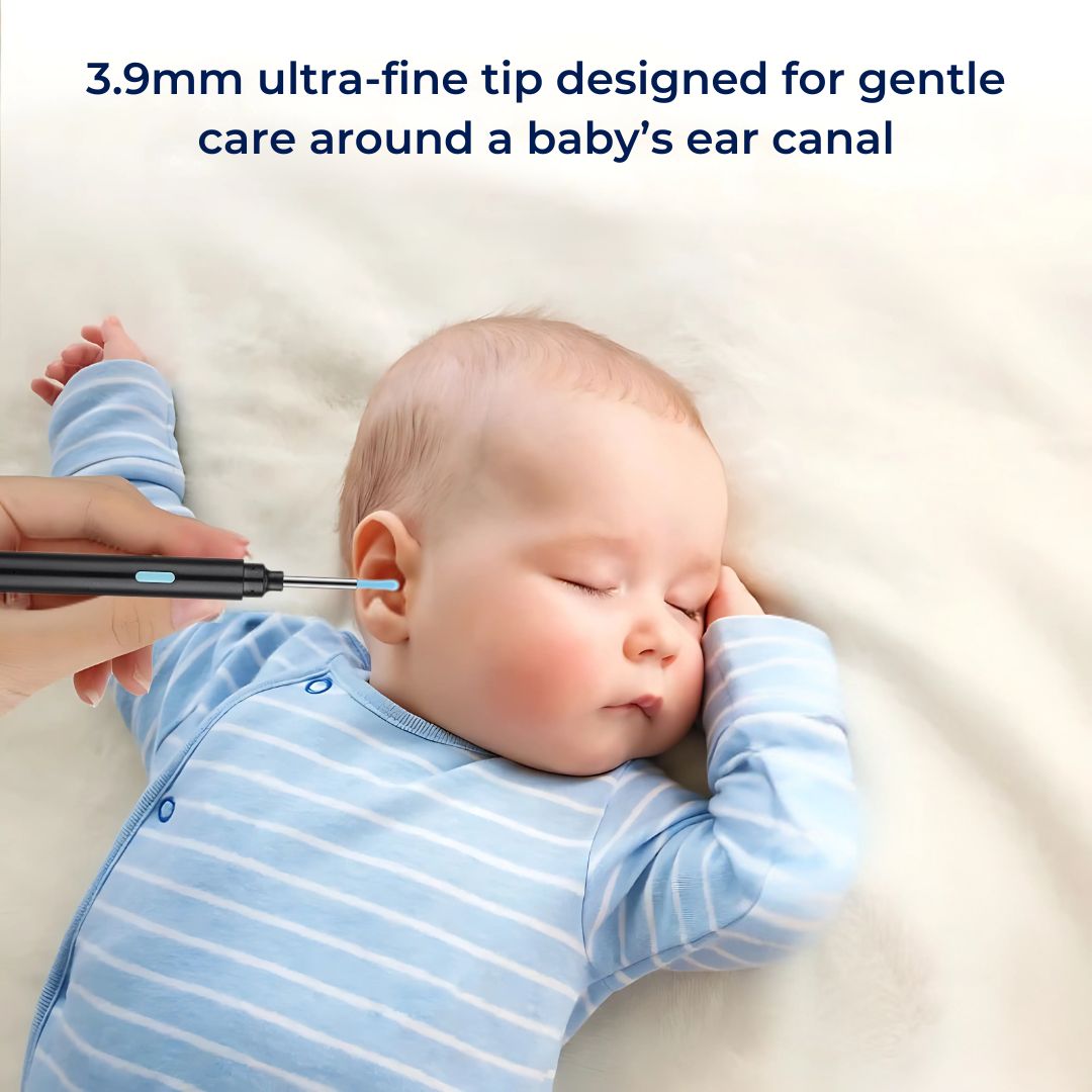 Earwax Removal Tool | Smart Visual with LED Camera & Soft Tips for Safe, Precise Ear Cleaning