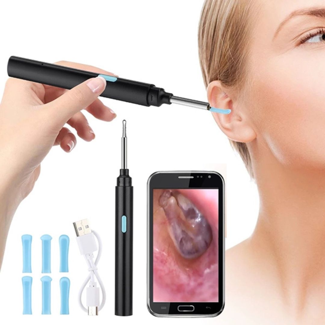 Earwax Removal Tool | Smart Visual with LED Camera & Soft Tips for Safe, Precise Ear Cleaning