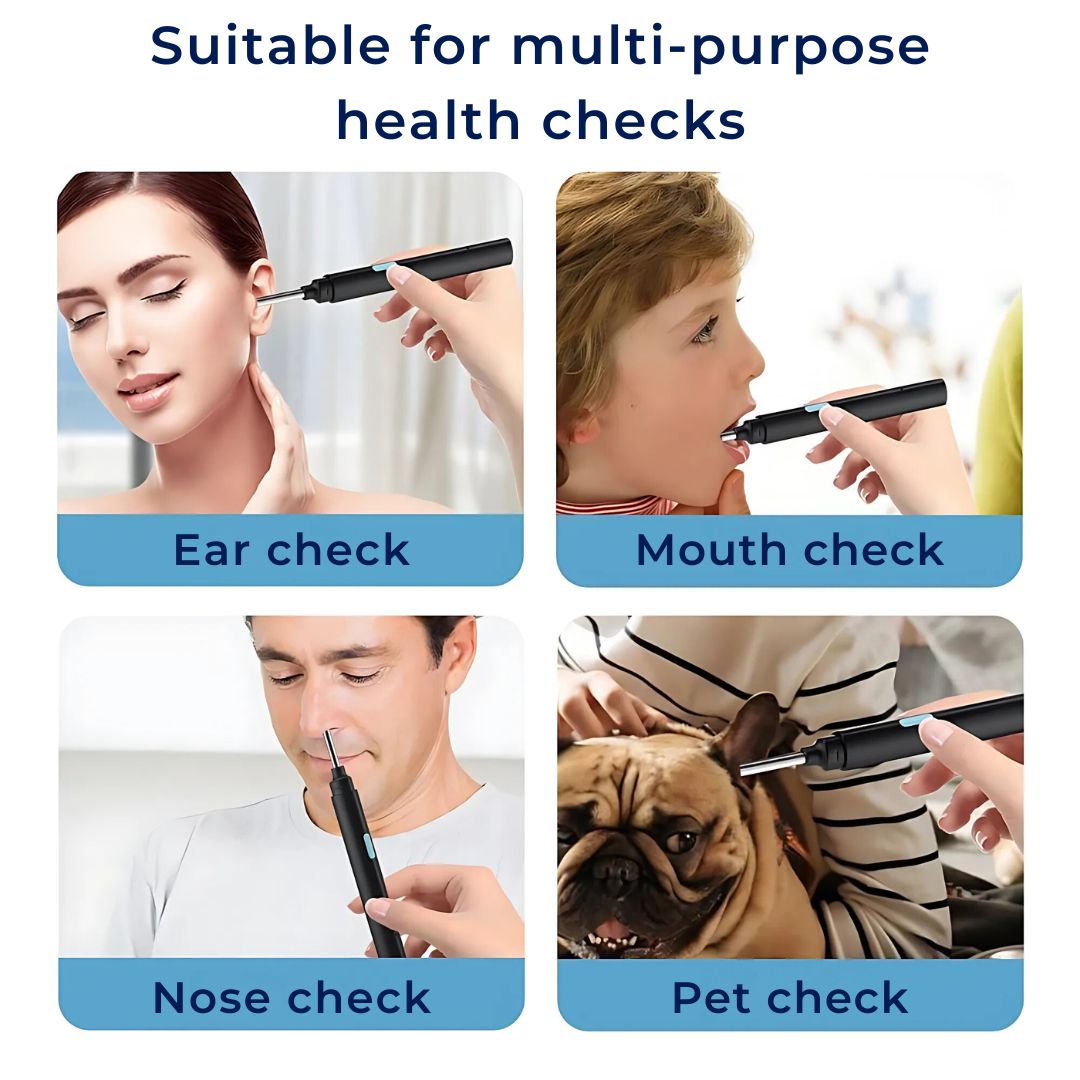 Earwax Removal Tool | Smart Visual with LED Camera & Soft Tips for Safe, Precise Ear Cleaning