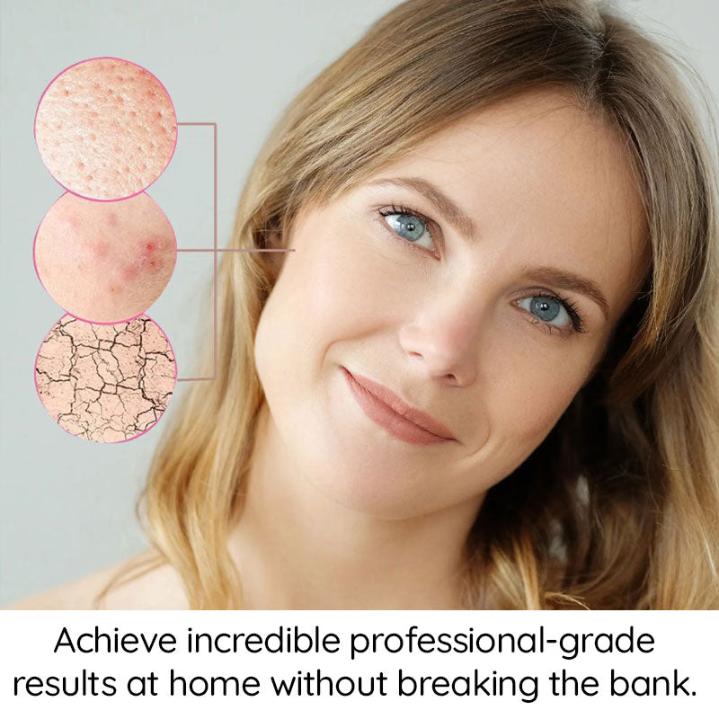 Skin Tag Remover Pen | Effortless, At-Home Treatment for Flawless Skin