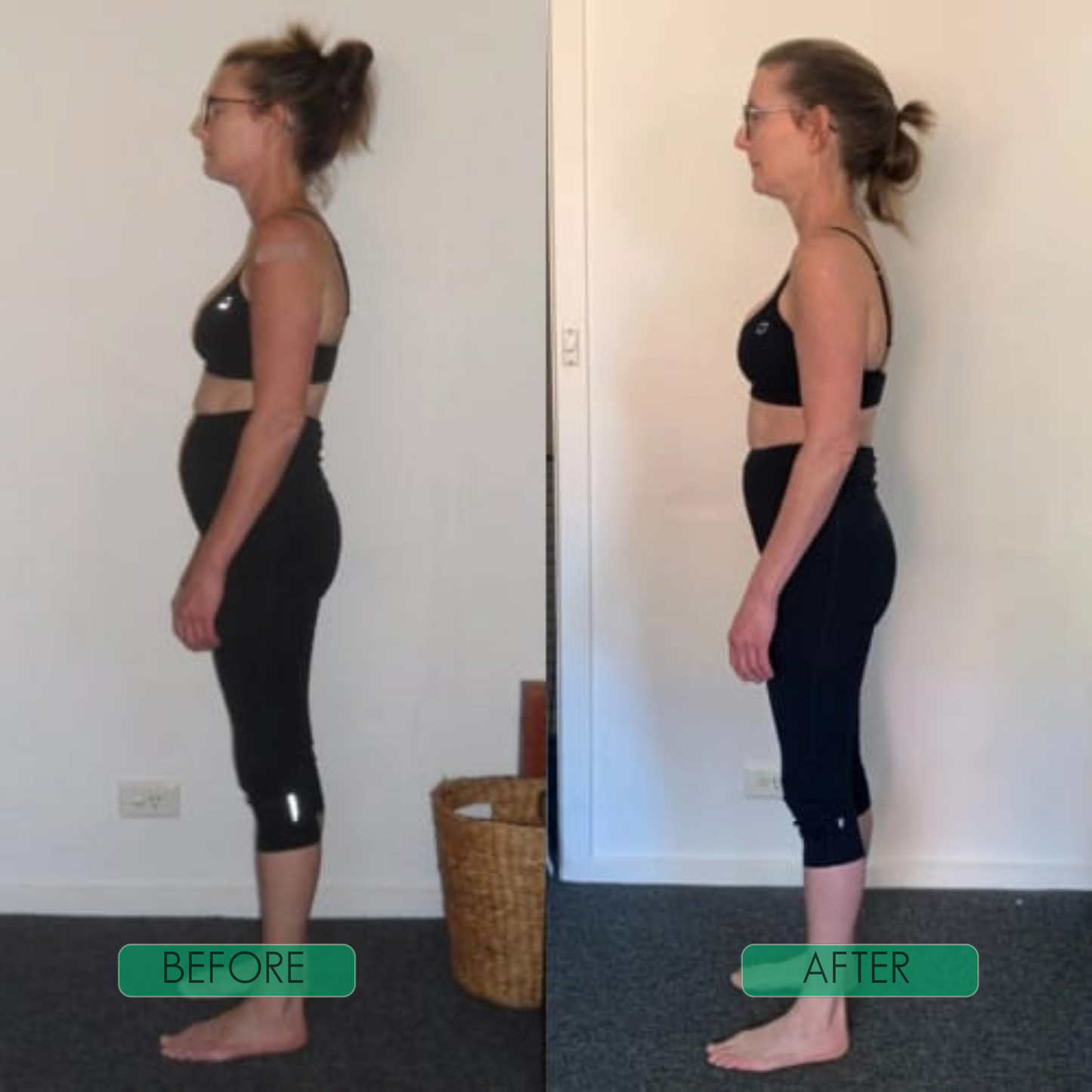 Instant Posture Corrector | Adjustable, Lightweight & Ideal for Office Use