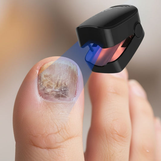 LumiCure PRO 2.0 - Mycosis Nail Fungus Treatment Laser Device for Effective Fungal Infection Removal at Home