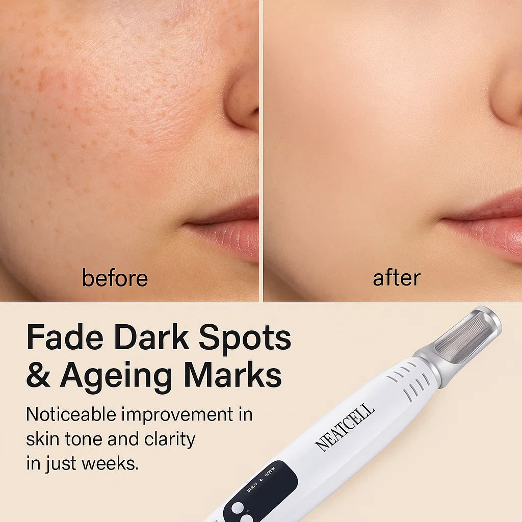 Picosecond Laser Pen for Dark Spot Removal - Light Therapy Skin Treatment Device for Hyperpigmentation and Age Spots