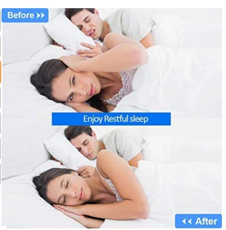 Nasal Dilator for Snoring Relief | Medical-Grade Silicone for Better Sleep & Easy Breathing at Night