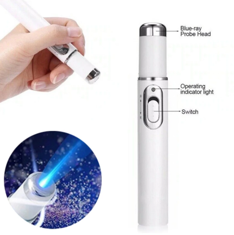 fungal-nail-treatment-laser