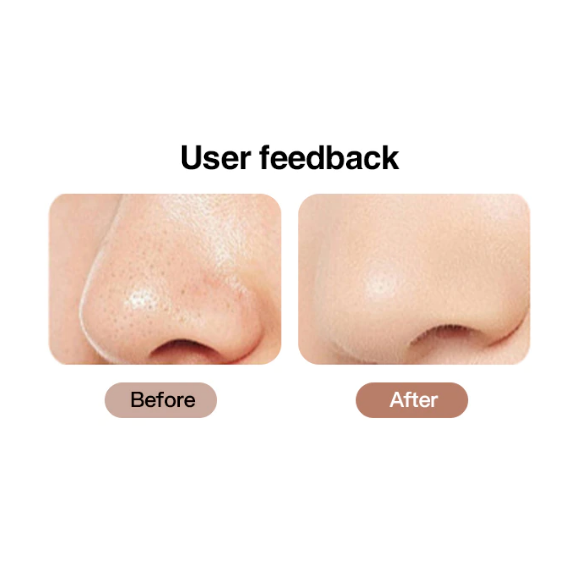 ultrasonic-skin-scrubber