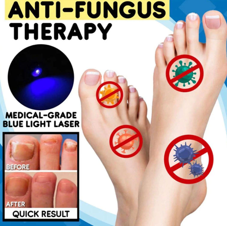 toenail-fungus-treatment
