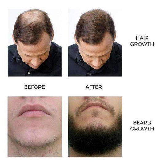 Pure Organic Ginger Hair Growth Essence