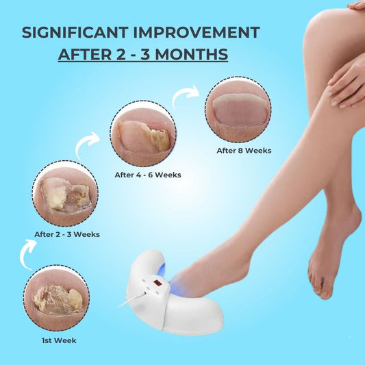 Toenail Fungus Laser Treatment | Non-Invasive, Effective & Safe Solution for Healthy Nails