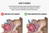 Image of Anti-Snoring Tongue Retainer Silicone Sleeve for Sleep Apnea Relief and Better Sleep Quality