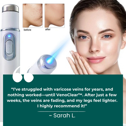 Non-Invasive Varicose Vein Treatment – VenoClear™ Laser Therapy Device