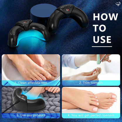 Nail Fungus Treatment Light – Advanced Therapy for Onychomycosis & Nail Health Restoration