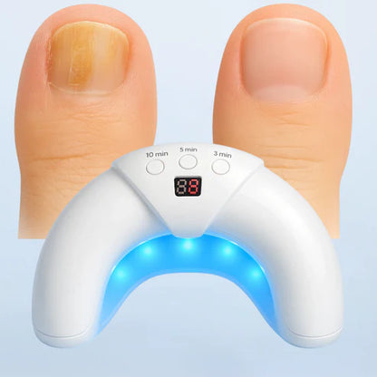 Nail Laser Fungus Device | Non-Invasive, FDA-Cleared Treatment for Fingernail & Toenail Fungus at Home