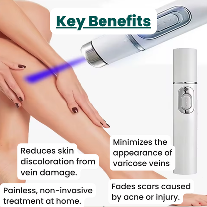 Non-Invasive Varicose Vein Treatment – VenoClear™ Laser Therapy Device