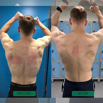 Instant Posture Corrector | Adjustable, Lightweight & Ideal for Office Use