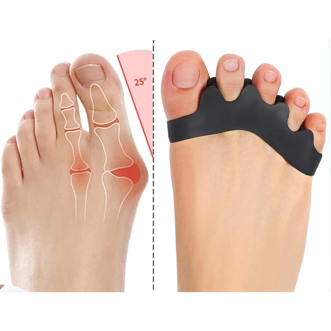 Toe Spacer for Realignment | Pain Relief for Bunions & Overlapping Toes, Ideal for Daily Foot Comfort