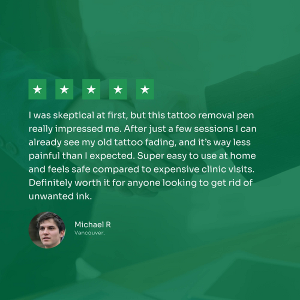 Tattoo Removal Laser Pen | Swift, Powerful & Safe for Effective Pigment Breakdown