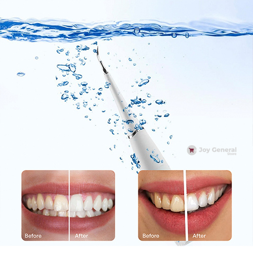 Tartar Remover for Teeth & Dental Scaler Tool | Ultrasonic Plaque Remover | Electric Teeth Cleaner At-Home Kit | 3-Mode