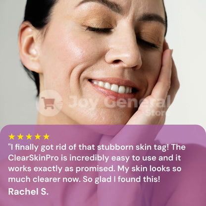 ClearSkinPro Laser Plasma Pen | Non-Invasive Freckle, Skin Tag, Spot, Mole & Tattoo Removal for At-Home Skin Care