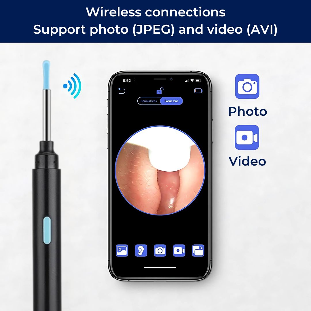 Earwax Removal Tool | Smart Visual with LED Camera & Soft Tips for Safe, Precise Ear Cleaning