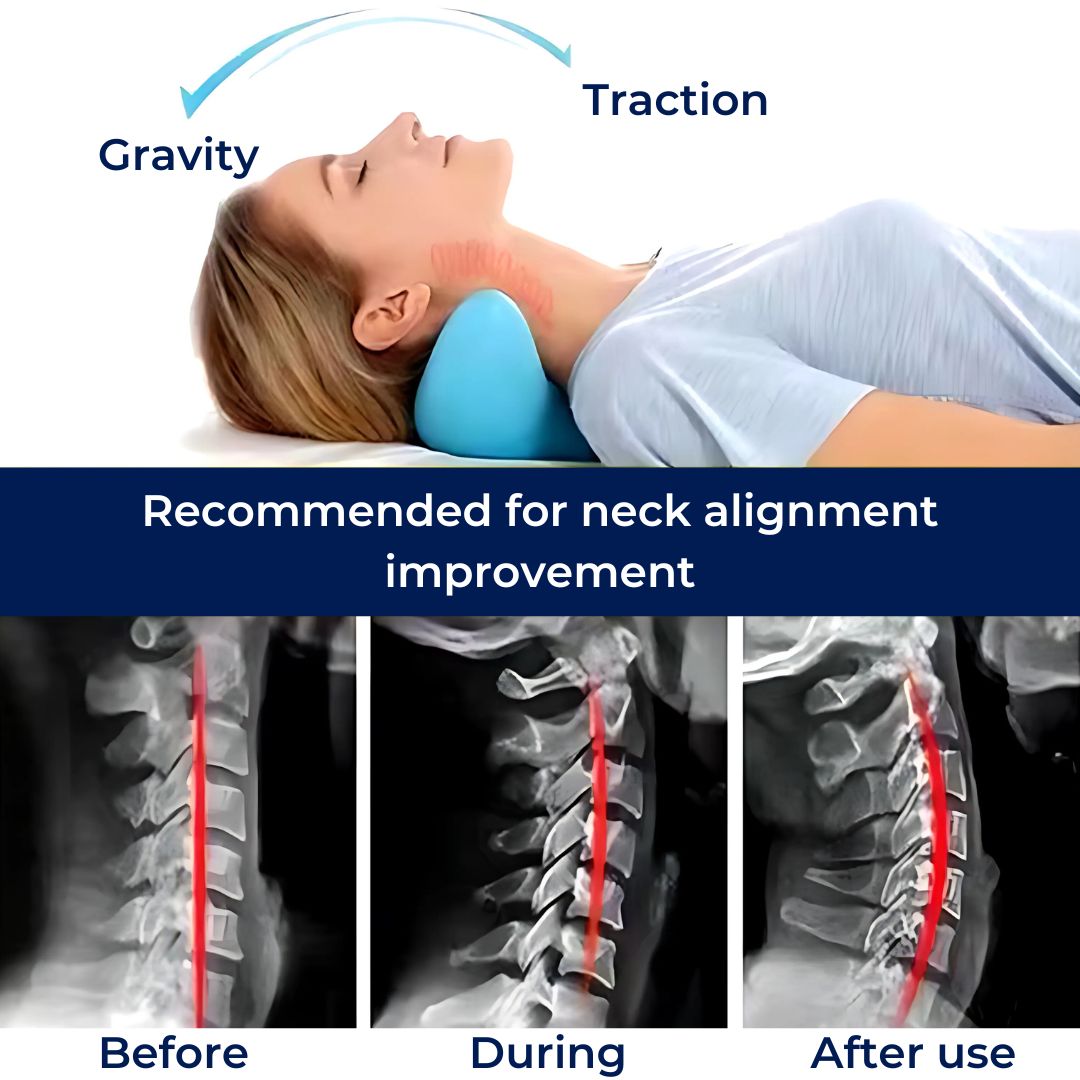 Chiropractic Neck Pillow | Pain Relief, Improved Posture & Better Sleep for Neck Tension Relief