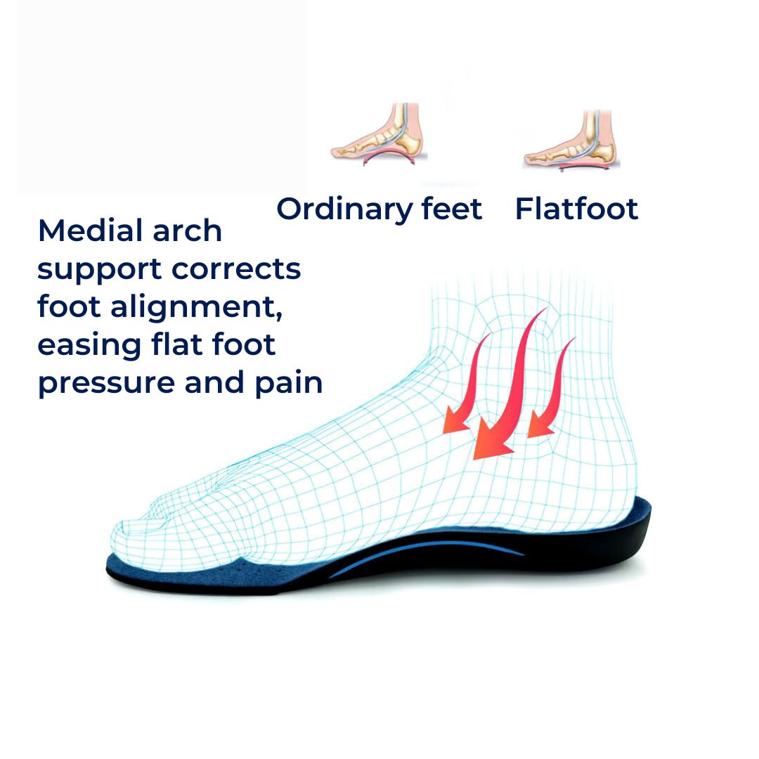 Pronation Support Inserts | Orthopedic Foot Alignment & Arch Relief for Overpronation and Plantar Fasciitis