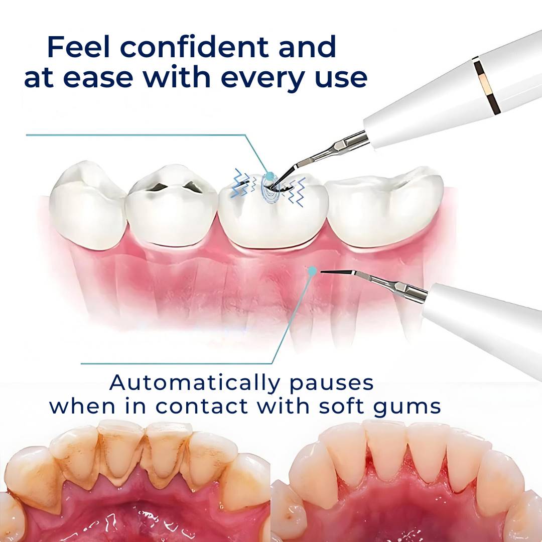 Ultrasonic Teeth Cleaner | Deep Plaque & Tartar Remover for Home Use, Promotes Gum Health
