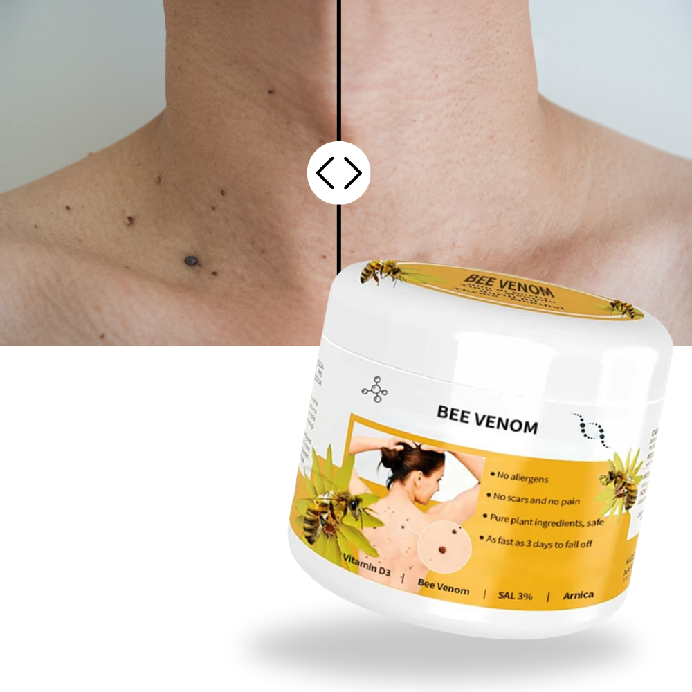Bee Venom Cream for Skin Renewal – Lightweight Botanical Ointment to Remove Skin Tags & Soothe All Types Bee Poison Cream