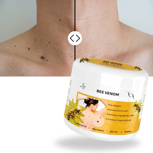 Bee Venom Cream for Skin Renewal – Lightweight Botanical Ointment to Remove Skin Tags & Soothe All Types Bee Poison Cream
