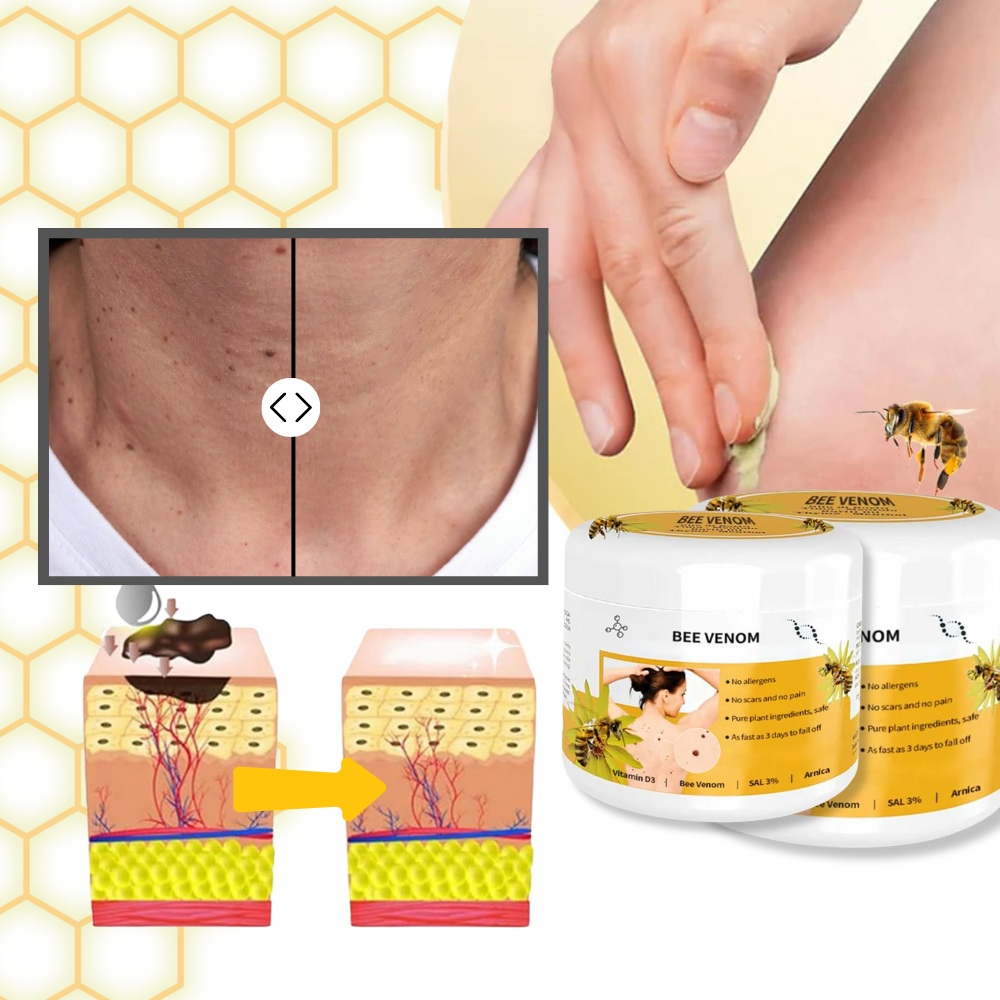 Bee Venom Cream for Skin Renewal – Lightweight Botanical Ointment to Remove Skin Tags & Soothe All Types Bee Poison Cream