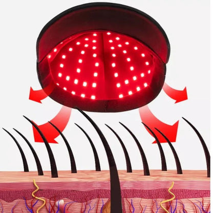 Red Light Infrared Laser Cap for Hair Growth – LED Therapy for Hair Loss Treatment and Regrowth
