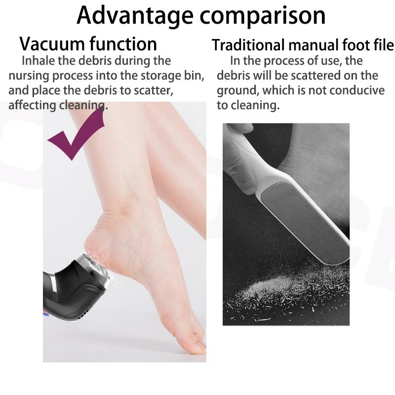 Professional Electric Foot Hard Skin Remover – Get Rid of Calluses & Rough Skin Easily
