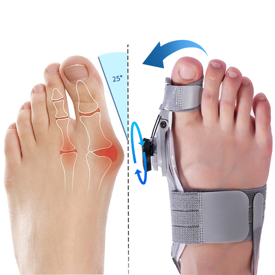Bunion Corrector Relief Device | Natural Alignment Therapy for At-Home Pain Alleviation and Toe Realignment