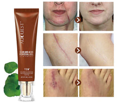 Acne Scar Treatment Repair Cream Scar Remover Promote Cell Regeneration Scar Removal Cream