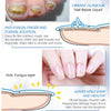 Image of Fingernail fungus - Fungal Nail Treatment - Toenail Fungus