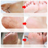 Image of Original Baby Foot Peel Exfoliating Mask