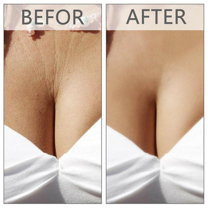 Silicone Chest Pads